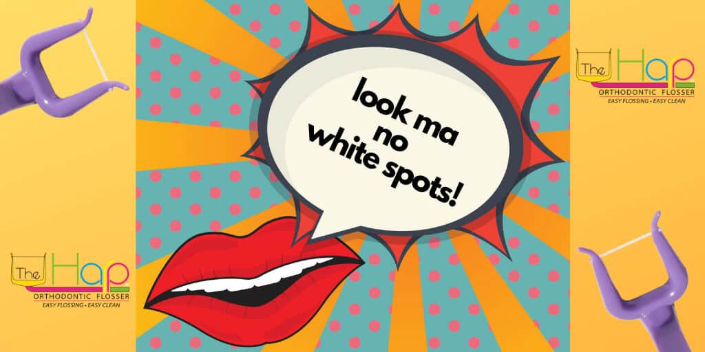 White Spots After Braces – Why?